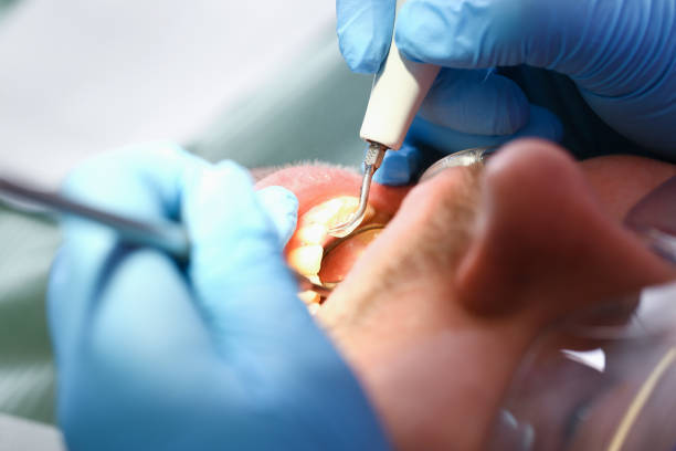 Best Emergency Dentist for Lost Fillings or Crowns in Antioch, CA
